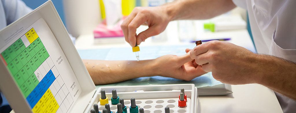 Allergietest wird an einem Arm durchgeführt